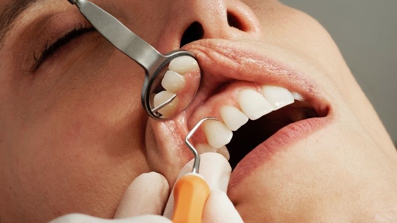 Symptoms And Signs You May Have Gum Disease