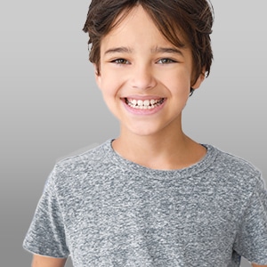 Invisalign for kids