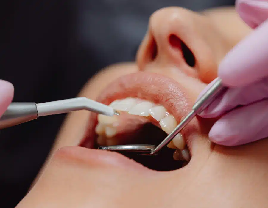 The Different Stages of an Effective Dental Cleaning The Different Stages of an Effective Dental Cleaning